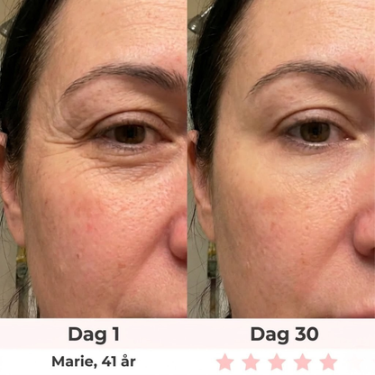 Auralyn 7-i-1 LED-ansiktsskulpterare