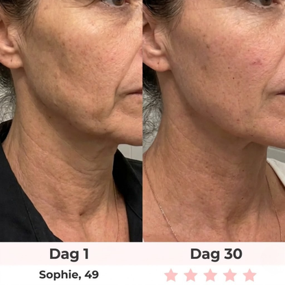 Auralyn 7-i-1 LED-ansiktsskulpterare