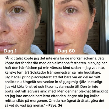 Auralyn 7-i-1 LED-ansiktsskulpterare