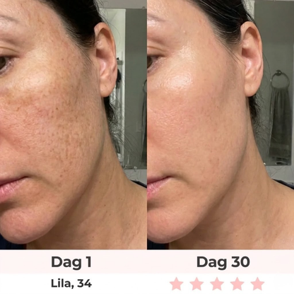 Auralyn 7-i-1 LED-ansiktsskulpterare