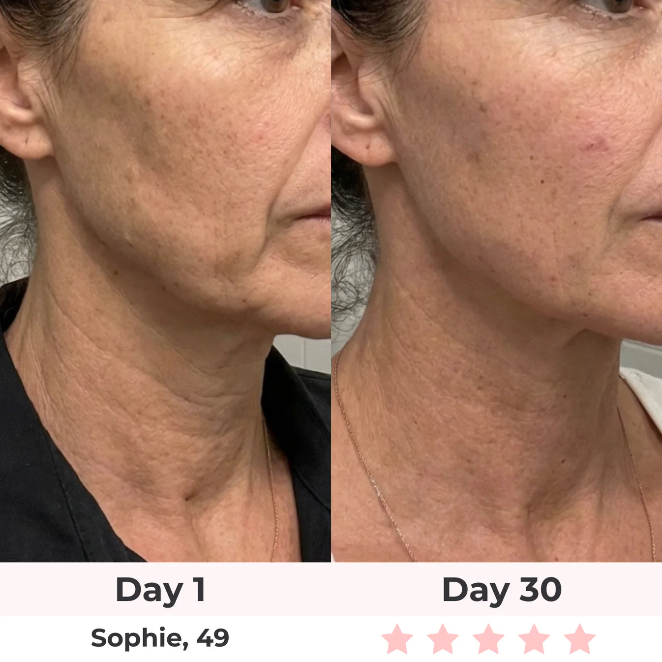 Bye-Bye Wrinkles & Double Chin &Saggy Neck –7-in-1 LED Face Lift & Sculptor