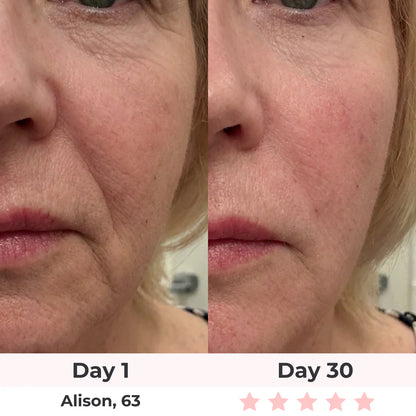 Bye-Bye Wrinkles & Double Chin &Saggy Neck –7-in-1 LED Face Lift & Sculptor