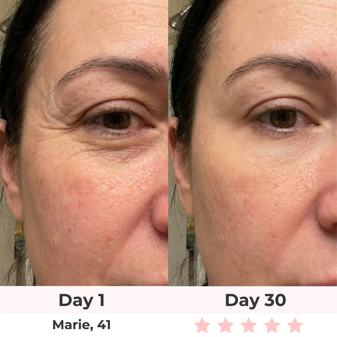 Bye-Bye Wrinkles & Double Chin &Saggy Neck –7-in-1 LED Face Lift & Sculptor