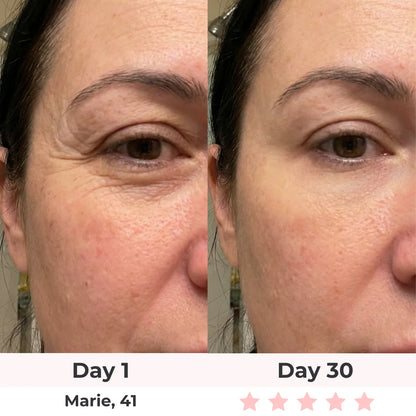 Bye-Bye Wrinkles & Double Chin &Saggy Neck –7-in-1 LED Face Lift & Sculptor